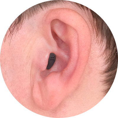 Completamente en el canal (CIC)